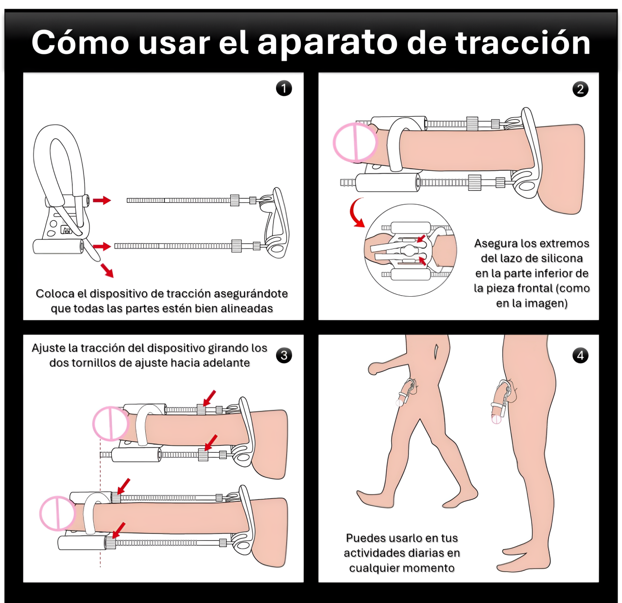 Extensor de Miembro en abrazadera